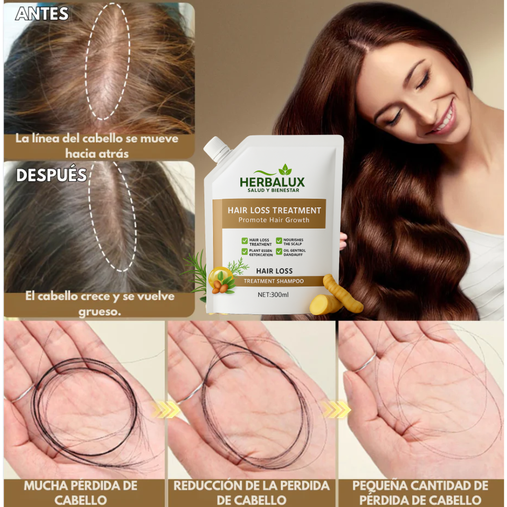 Anti-Hair Fall Shampoo - Anti-Caída y Reactivación Capilar