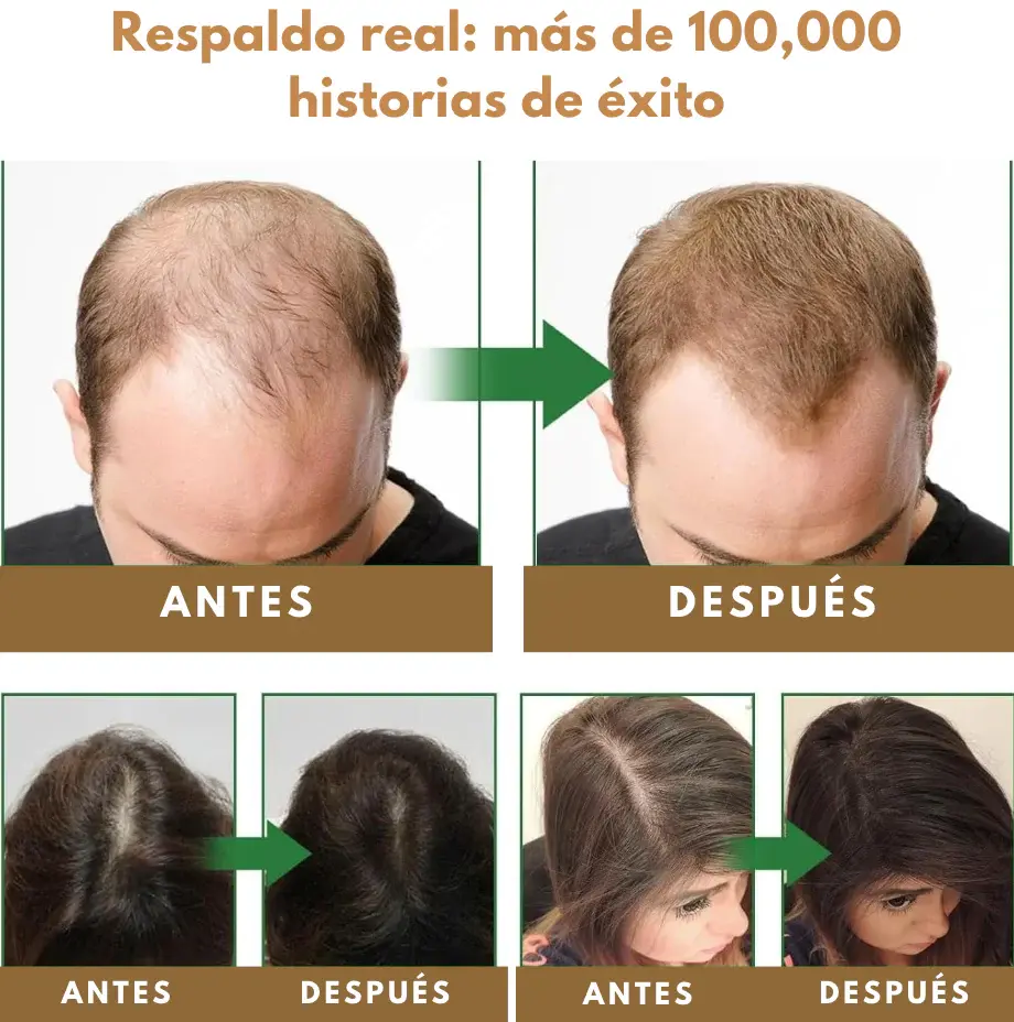 Anti-Hair Fall Shampoo - Anti-Caída y Reactivación Capilar HerbaLux