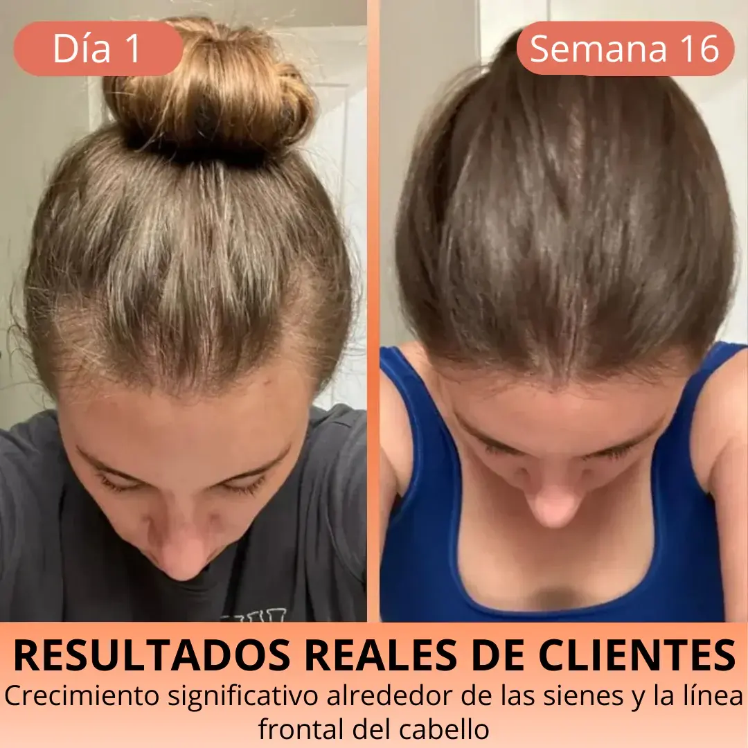 Aceite de Semilla de Calabaza 3000 mg – Cabello Fuerte y Piel Radiante HerbaLux