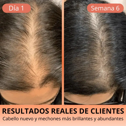 Aceite de Semilla de Calabaza 3000 mg – Cabello Fuerte y Piel Radiante HerbaLux