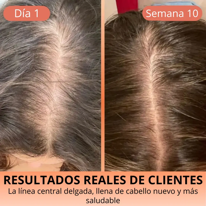 Aceite de Semilla de Calabaza 3000 mg – Cabello Fuerte y Piel Radiante HerbaLux